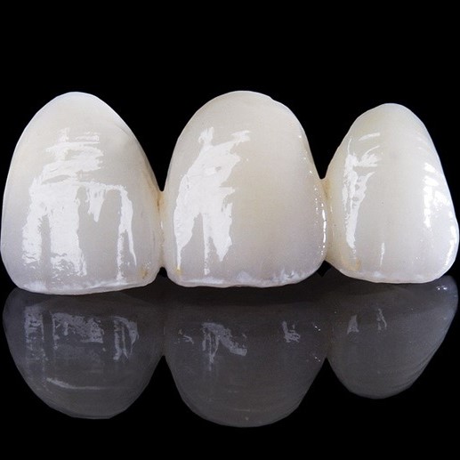 RĂNG SỨ ZIRCONIA NHẬT