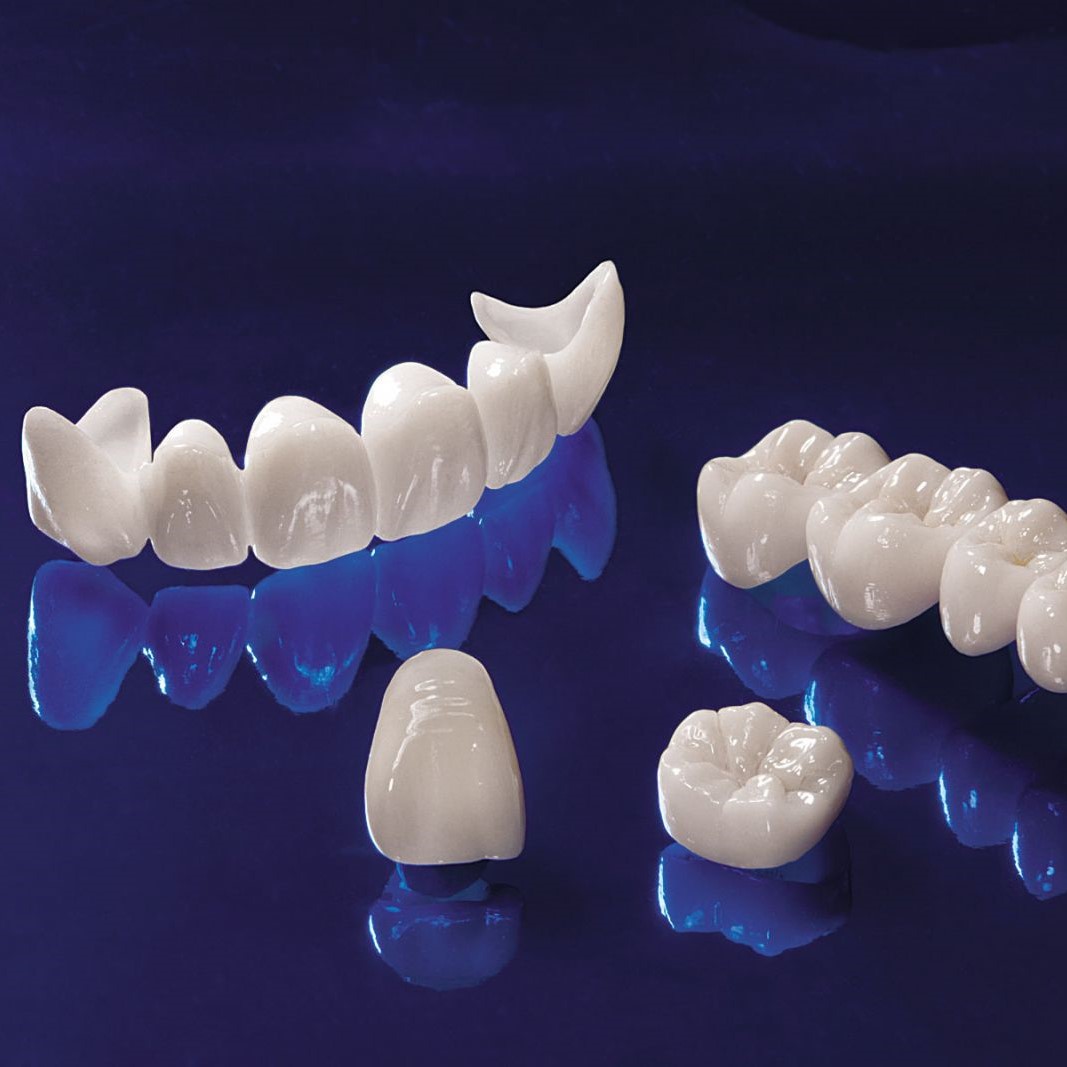 SỨ NONE PREP E.MAX